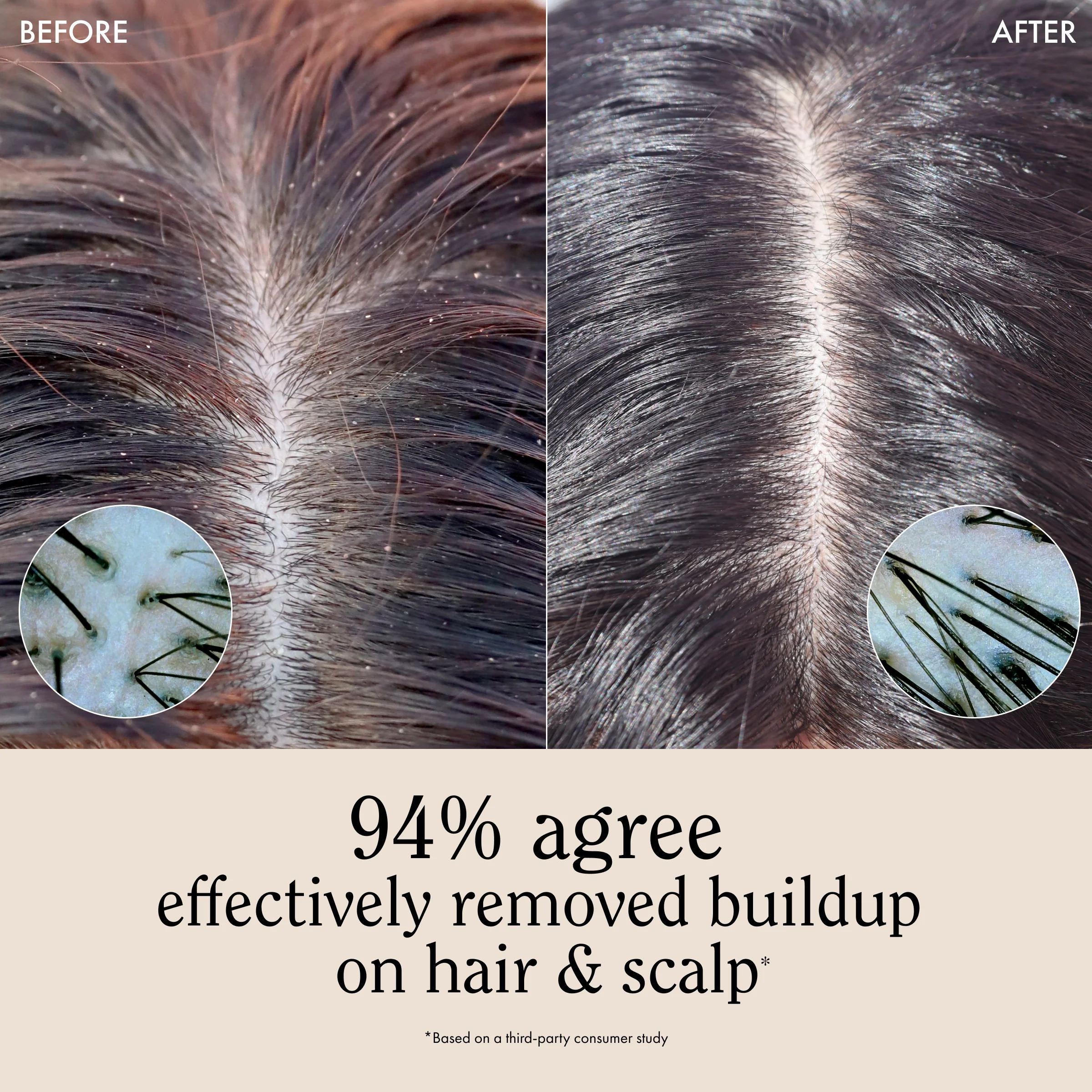 Travel Size Apple Cider Vinegar Scalp & Hair Rinse - Image 3