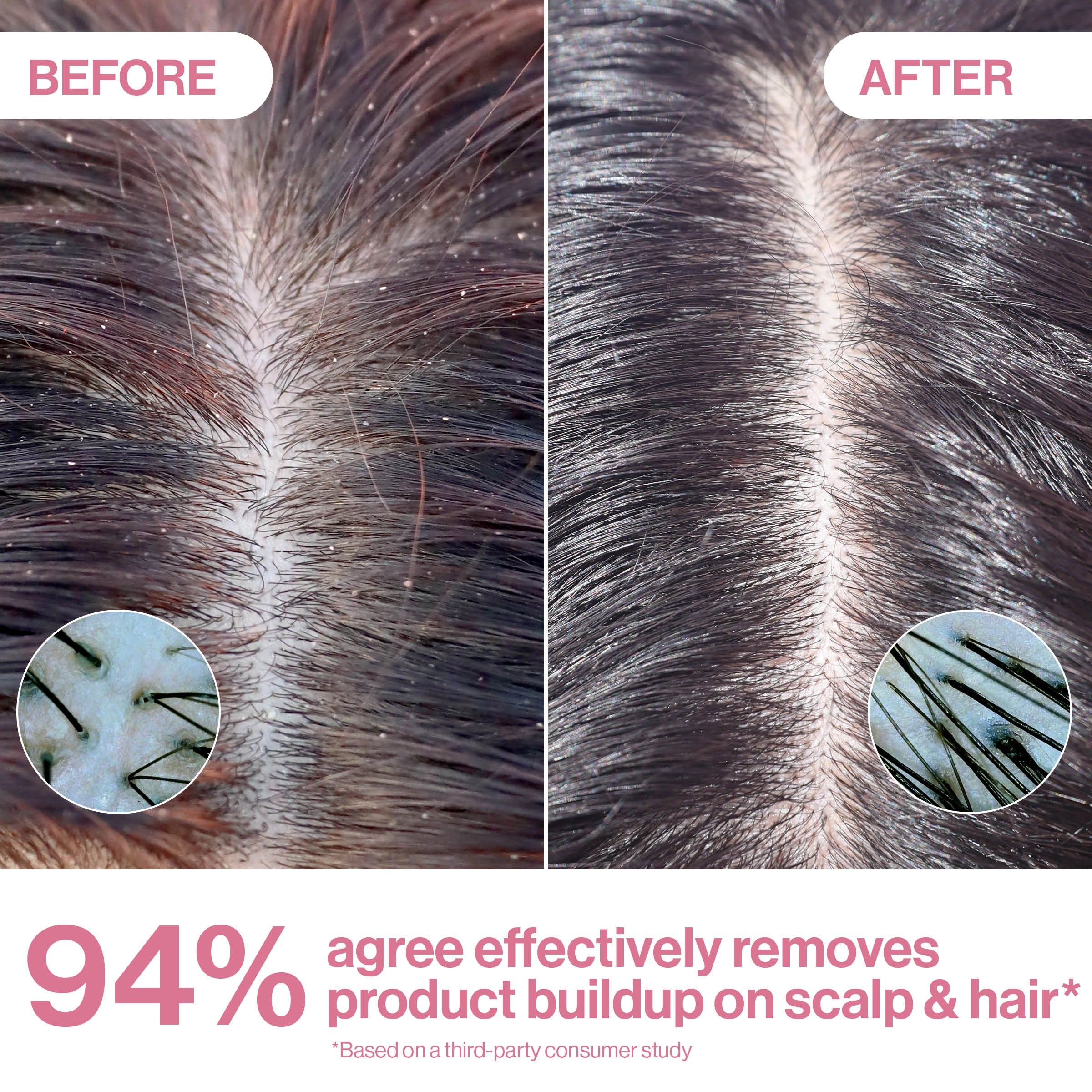 The Complete Scalp Care Bundle - Image 3